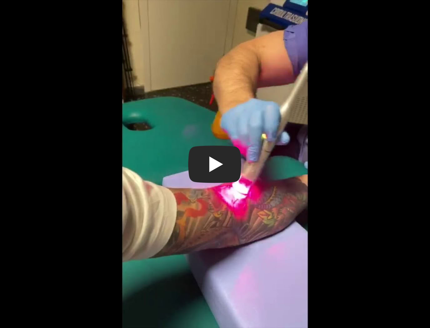 Video Riproduci Video