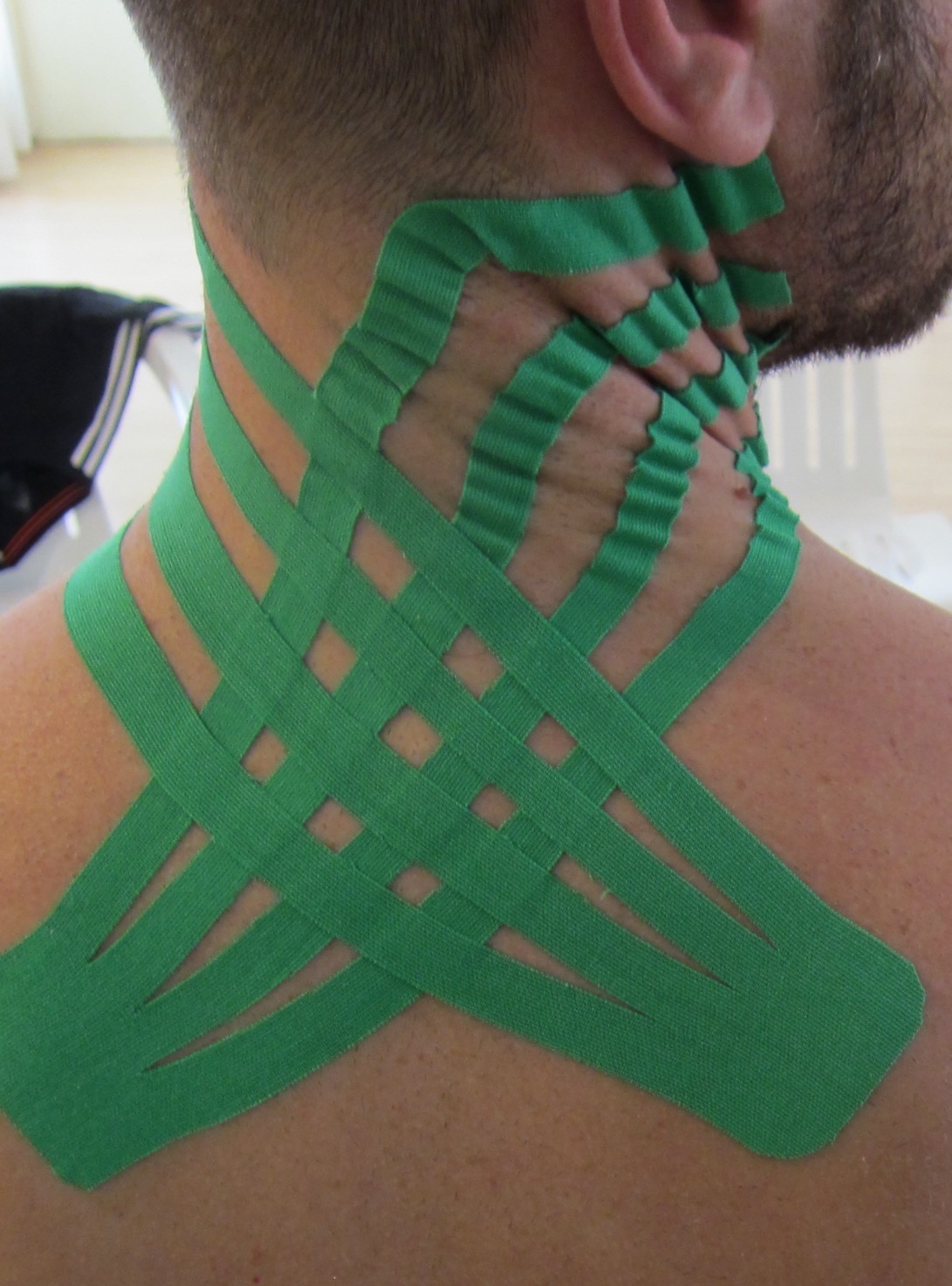 Applicazione di taping chinesiologico sulla regione cervicale